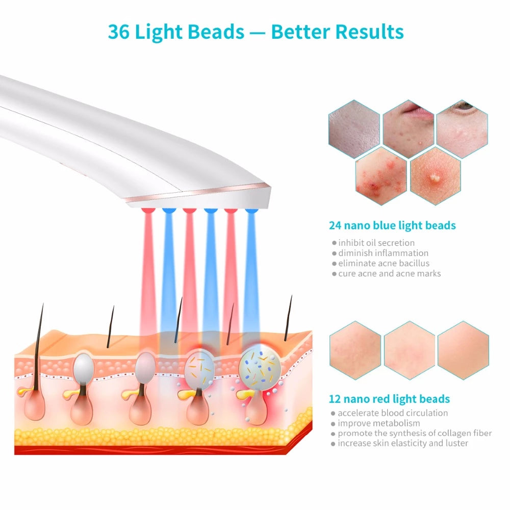 Kabellose Akne Lichttherapie Gerät Blaulicht Und Rotlicht - Hobbyfy