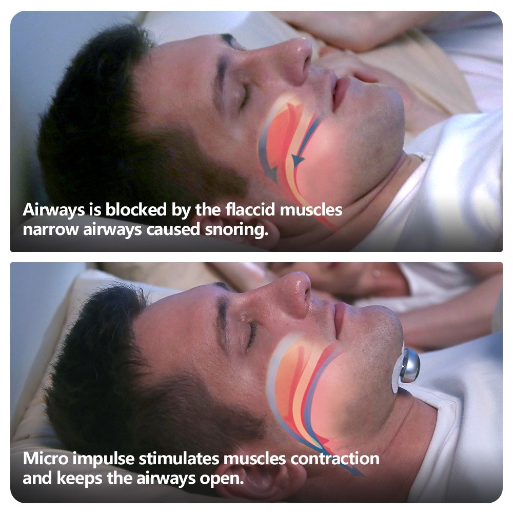 Anti-Schnarch Pro Muskelstimulator Hypoallergenes Silikon - Hobbyfy